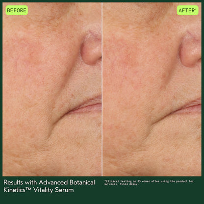 ADVANCED BOTANICAL KINETICS™ VITALITY SERUM 30 ML