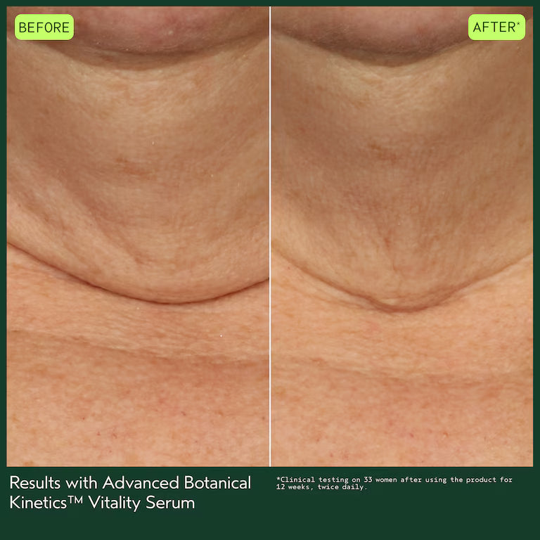 ADVANCED BOTANICAL KINETICS™ VITALITY SERUM 30 ML